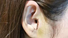 女人在鼻子工作手术期间不知不觉地将耳朵移开