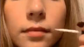 健康专家警告说，将顶唇粘在鼻子下的皮肤上的新美容趋势