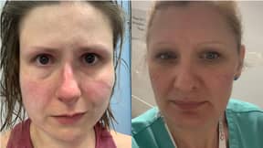 NHS员工分享瘀伤面孔的照片，以鼓励社会疏远