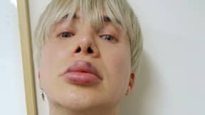 由于化妆品唇部治疗，英国K-POP Star无法正常唱歌