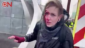女人骨折在荷兰被警察水炮击中后头骨