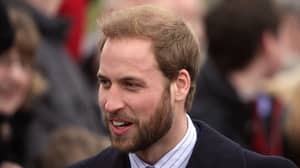 威廉王子拥抱秃头，刮胡子掉头发