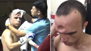 泰拳拳击手后泰国拳击手在残酷的肘部后遭受头骨骨折