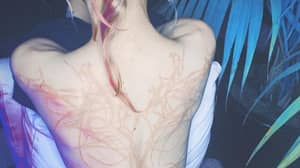 伊隆麝香的女朋友生气展示了巨大的新的“外星人伤疤”背纹身