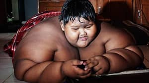 “世界上最胖的男孩”在救生手术后失去了一半的体重