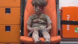 成为受灾城市象征的阿勒颇男孩现在更好