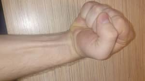 大约15％的人手臂没有这个肌肉