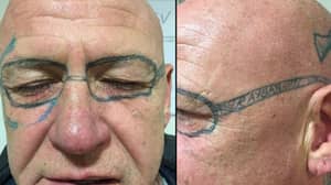 一名男子花了两年时间摘掉脸上纹身的眼镜