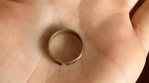 愤怒的妻子发现她的'18ct金子'婚戒是一个烧伤它的黄铜