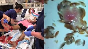 澳大利亚一名青少年被海虫“吃掉”后，脚一直在流血
