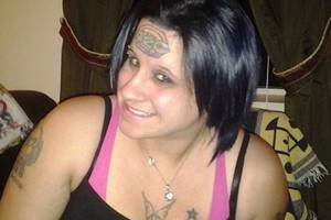 帮助这个随机的女士从额头上移除她的420纹身！
