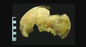 5000岁的头骨发现了古脑手术的人