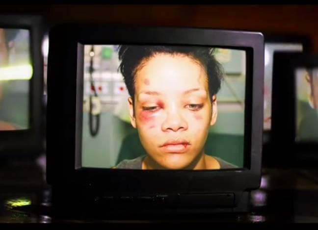 攻击后的蕾哈娜（Rihanna）：克里斯·布朗（Chris Brown）：欢迎来到我的生活/铆接娱乐必威betway微博