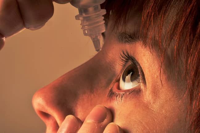使用药眼滴可以帮助水状和发痒的窥视器。信用：PA