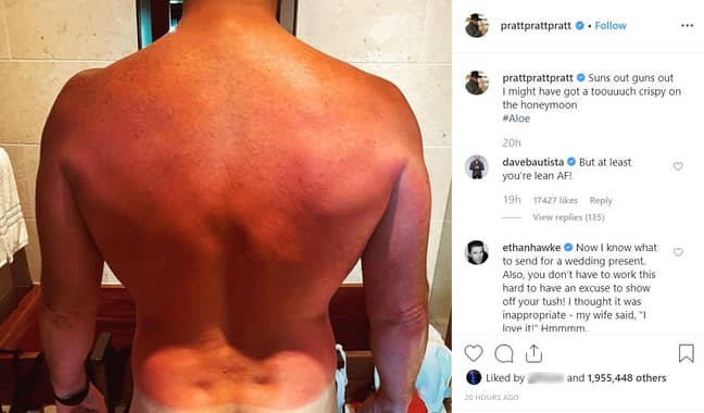 克里斯·普拉特（Chris Pratt）将晒伤的照片发布到Instagram。学分：Instagram/@prattprattpratt