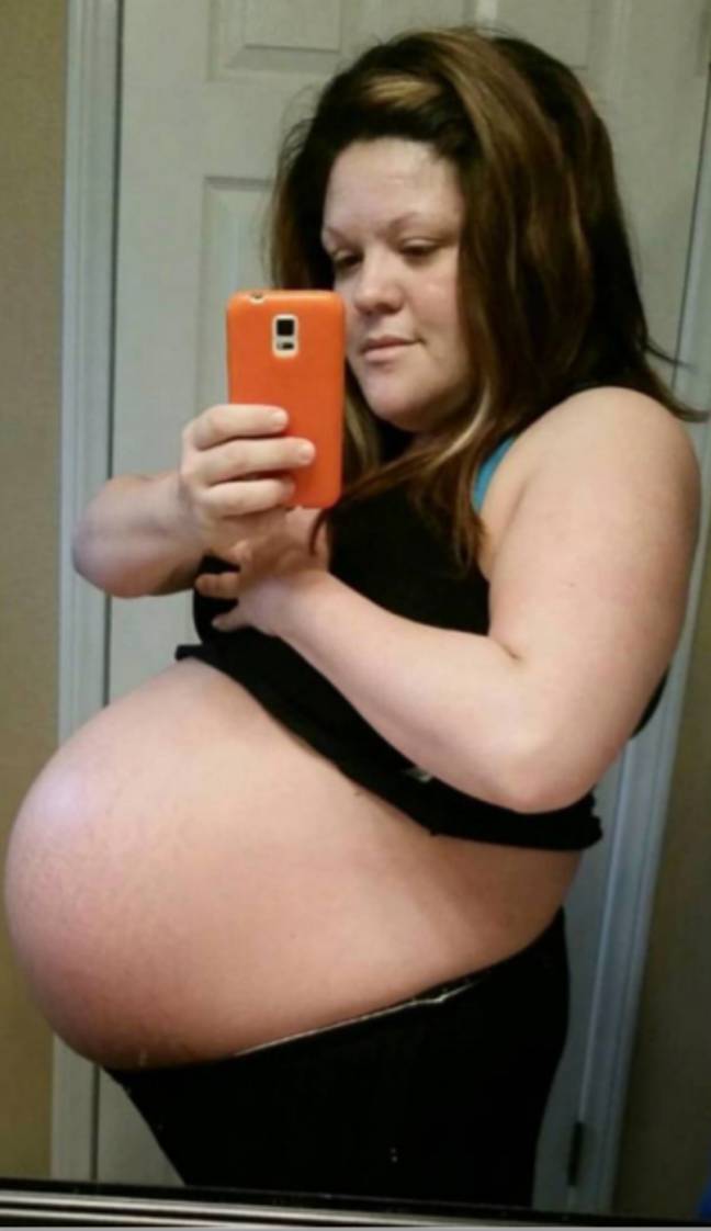 梅丽莎怀孕与双胞胎。信用：媒体鼓世界“width=