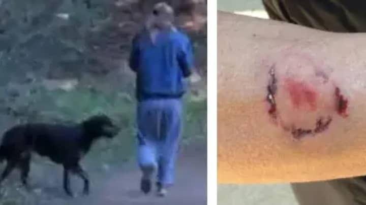 女人因涉嫌咬人的慢跑者而被捕，后者喷了她的狗