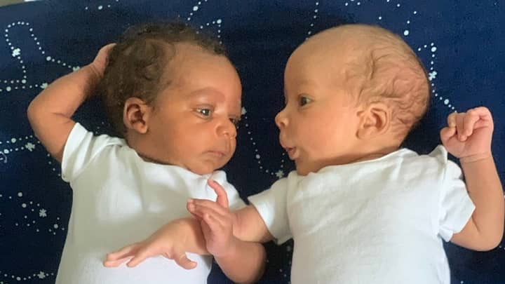妈妈生下了双胞胎儿子，他们看起来像是“两个不同的种族”