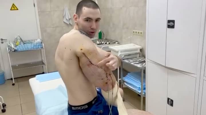 “俄罗斯平皇”进行手术，以从假肌肉中去除硬化的果冻