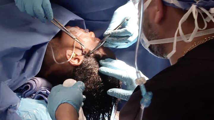 镜头显示了头发上的大猩猩胶的女性手术成功的手术