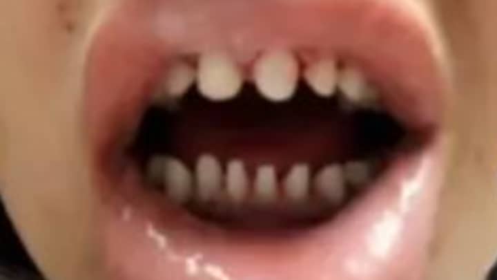 牙医警告剃须的tiktokers，他们在40多岁时需要牙齿