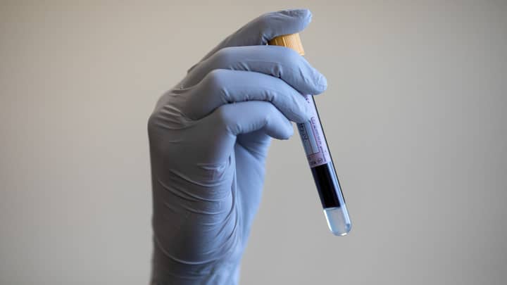 NHS试验“革命性”血液测试，可以检测50种癌症