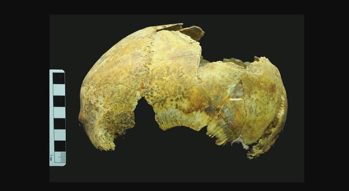5,000岁的头骨发现了接受古老脑部手术的人